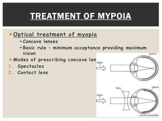 What Are Your Treatment Options for Myopia Correction?