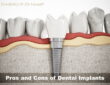 Recognizing Dental Implant Surgery's Advantages and Procedure