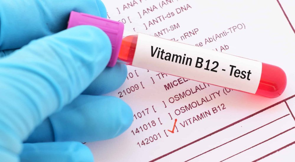 Vitamin B12 Test Explained What You Need to Know for Optimal Health