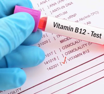 Vitamin B12 Test Explained What You Need to Know for Optimal Health