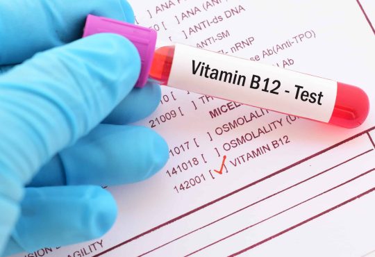 Vitamin B12 Test Explained What You Need to Know for Optimal Health