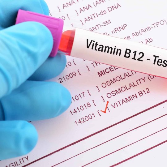 Vitamin B12 Test Explained What You Need to Know for Optimal Health