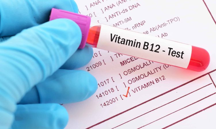 Vitamin B12 Test Explained What You Need to Know for Optimal Health